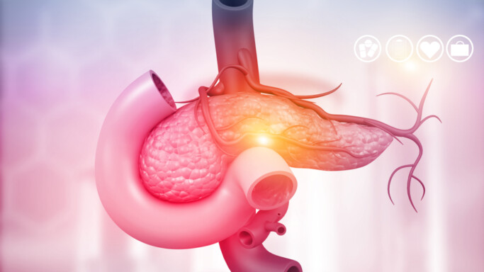 Onderzoek - Deltaplan Alvleesklierkanker
